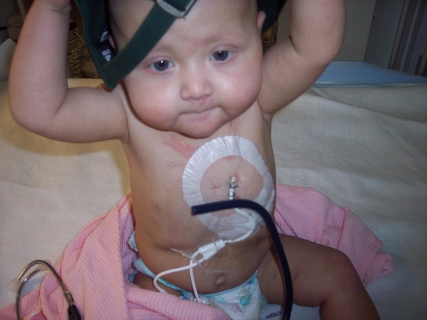 Baby Jada during her treatment at Providence Sacred Heart Medical Center